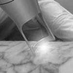 MedizinProdukteSicherheit BiAxis Laser by HLS Foto Copyright Doctare Laser 2025