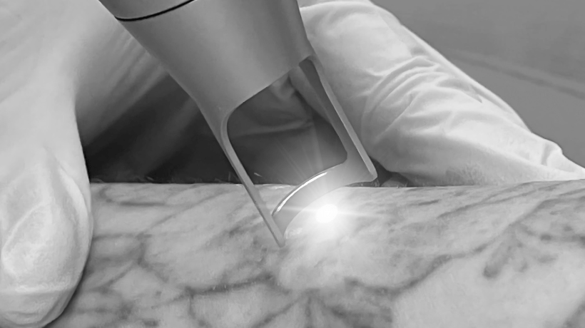 MedizinProdukteSicherheit BiAxis Laser by HLS Foto Copyright Doctare Laser 2025