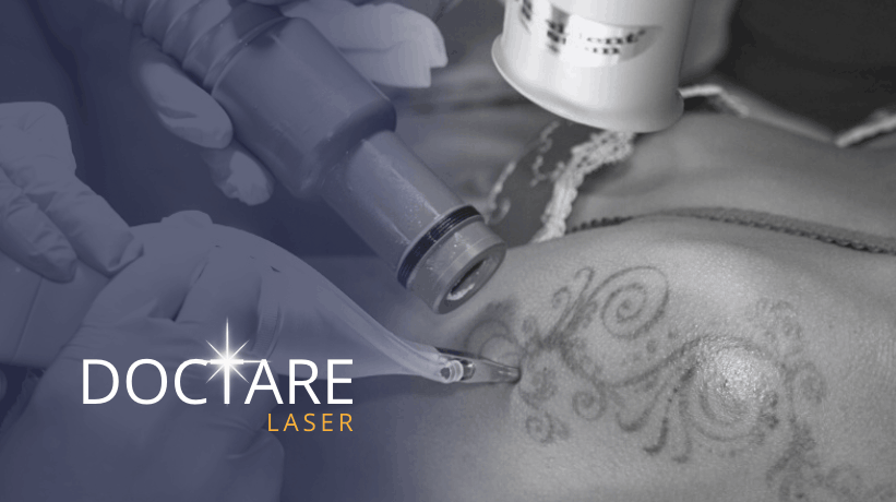 Doctare Laser Blog Foto Dr. Yael Adler Tattooentfernung lasern kühlen absaugen von 2013 Copyright Doctare Laser 2026